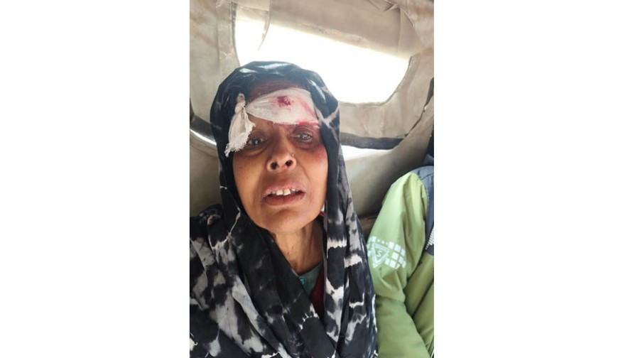 ভোটের পরে চৌগাছায় মারমারি: নারীসহ ৪ জামায়াত সমর্থক আহত