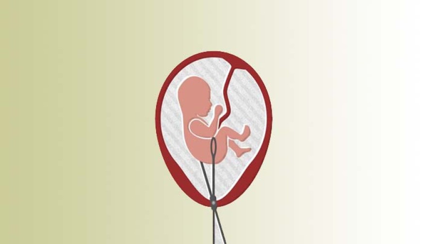 মারপিট ও ভ্রুন হত্যার অভিযোগে স্বামী-সতিনের নামে মামলা