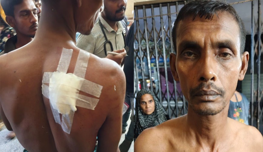 যশোর বড় বাজারে ডিউটিরত নাইট গার্ডকে চাকু মেরে জখম