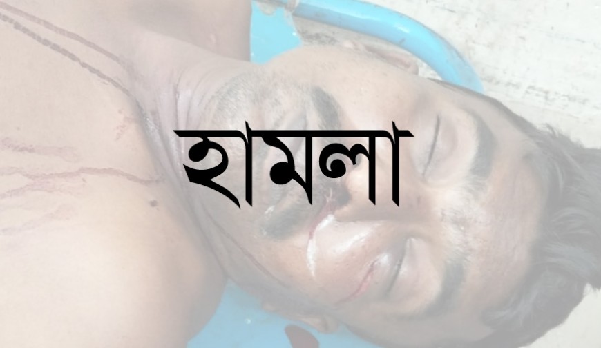 পুটখালিতে ব্যবসায়ীর মুখে দায়ের কোপ