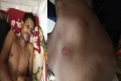 বেনাপোলে ১০ লাখ টাকা চাঁদার দাবিতে বিএনপি কর্মীকে হাতুড়িপেটা