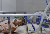 হাম ও হামের উপসর্গে মৃত্যু ৭০০ ছাড়াল